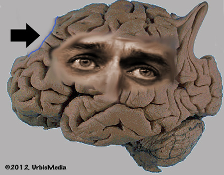 Ryan brain showing missing area that governs ability to tell the truth